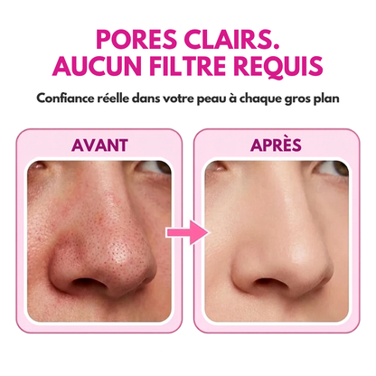 ELIRA™ | PoreClean Pro